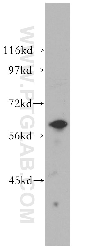 Western Blot (WB) analysis of Jurkat cells using KPNA5 Polyclonal antibody (13963-1-AP)