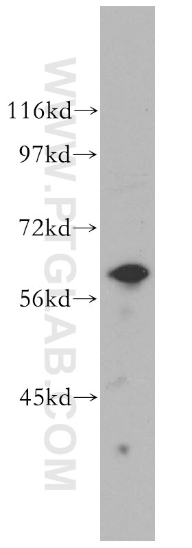 Western Blot (WB) analysis of Jurkat cells using KPNA5 Polyclonal antibody (13963-1-AP)