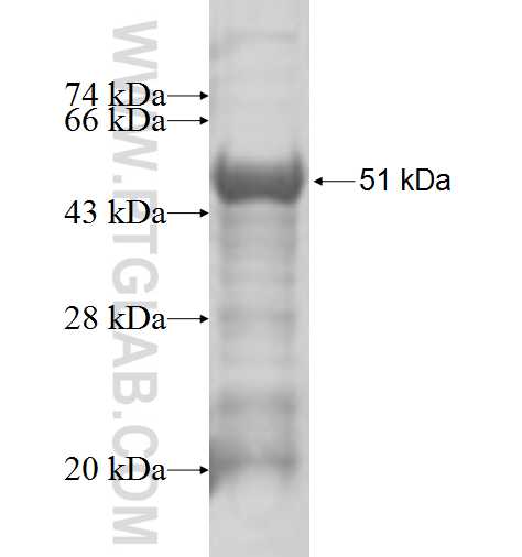 KPNA5 fusion protein Ag4920 SDS-PAGE