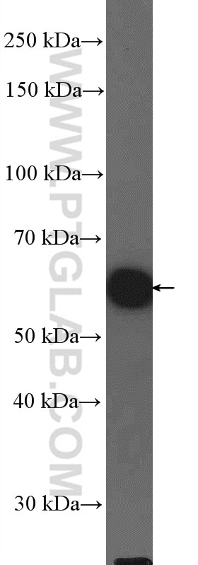 Western Blot (WB) analysis of BxPC-3 cells using KPNA6 Polyclonal antibody (12366-2-AP)
