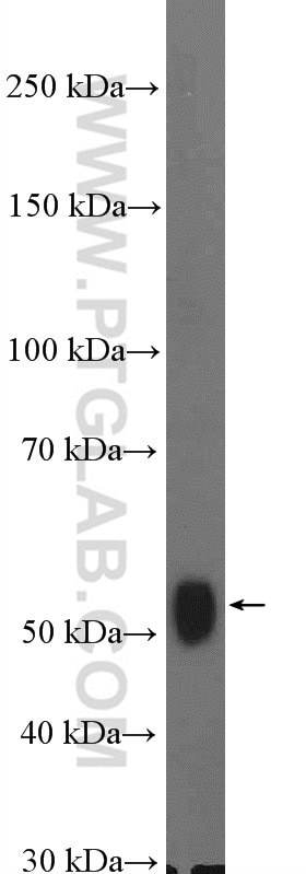 Western Blot (WB) analysis of HeLa cells using KPNA6 Polyclonal antibody (12366-2-AP)