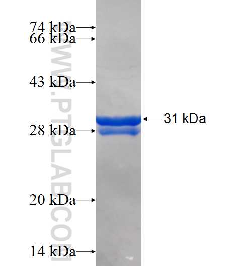 KPNA6 fusion protein Ag25738 SDS-PAGE