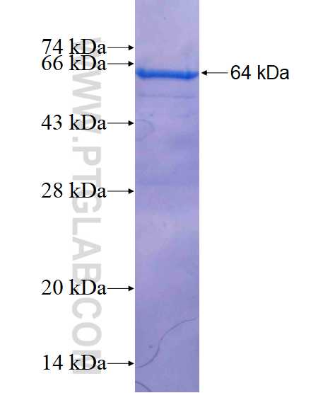 KPNA6 fusion protein Ag3040 SDS-PAGE