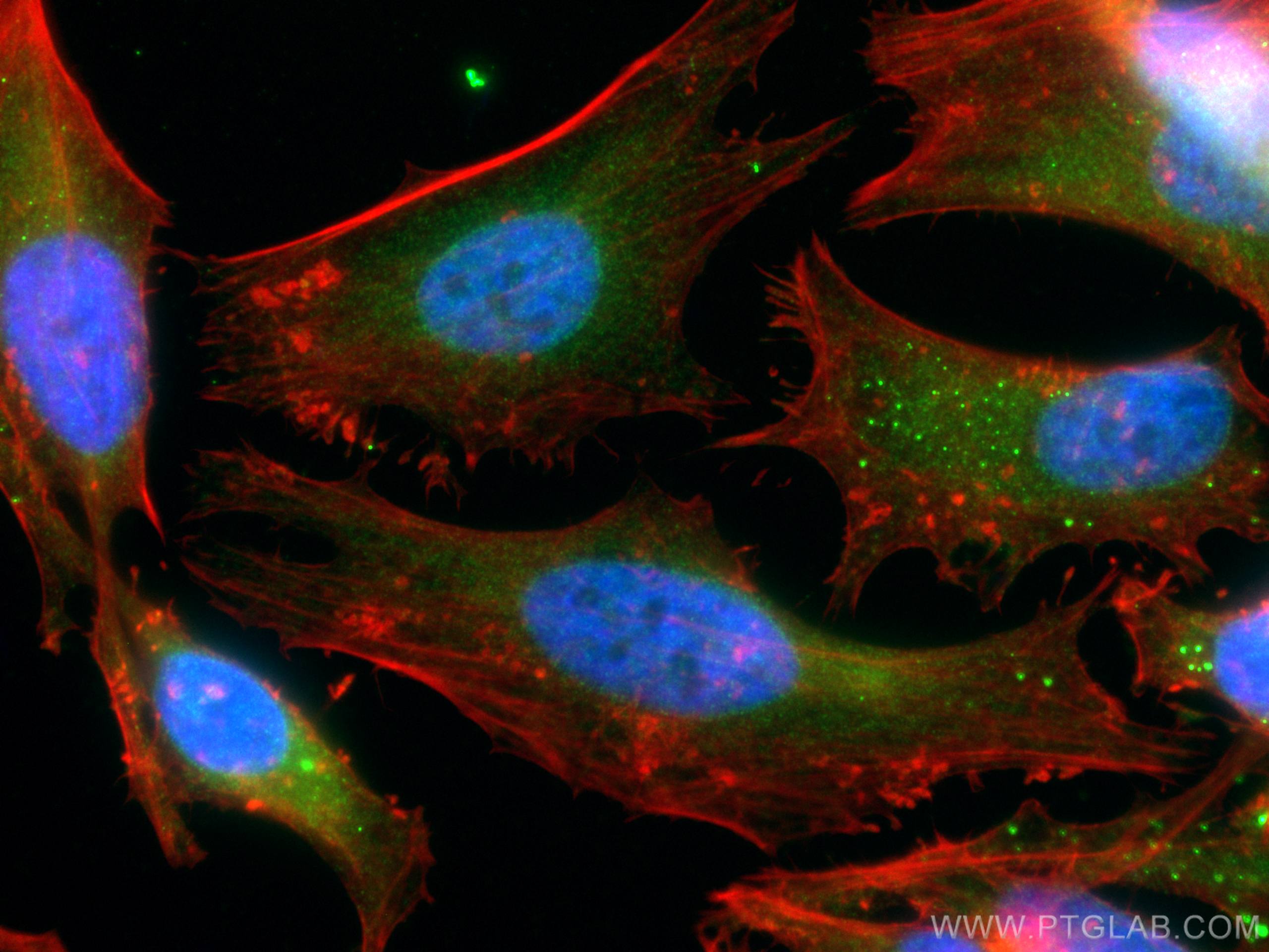 Immunofluorescence (IF) / fluorescent staining of HeLa cells using Importin Beta Polyclonal antibody (10077-1-AP)