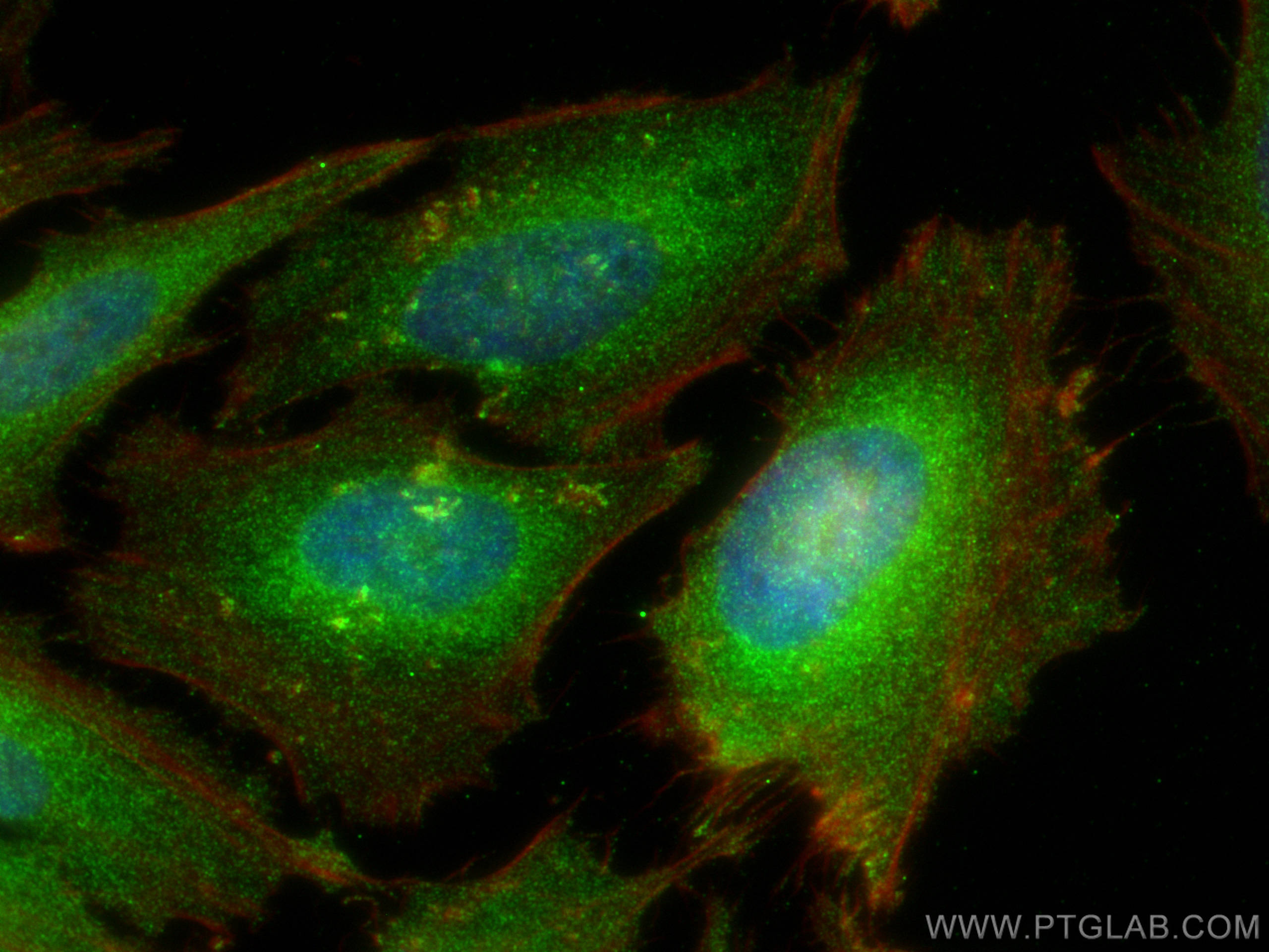 Immunofluorescence (IF) / fluorescent staining of HeLa cells using Importin Beta Polyclonal antibody (10077-1-AP)