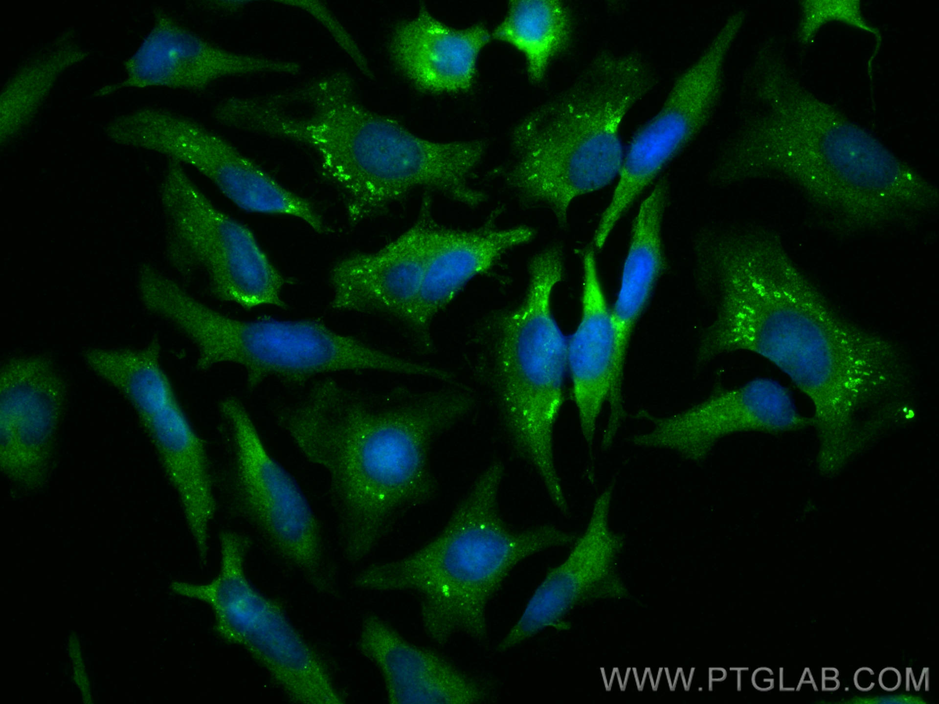 Immunofluorescence (IF) / fluorescent staining of HeLa cells using Importin Beta Polyclonal antibody (10077-1-AP)