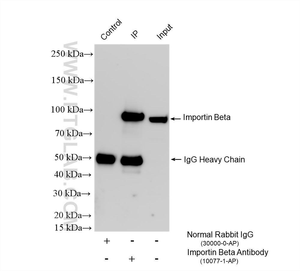 Immunoprecipitation (IP) experiment of A2780 cells using Importin Beta Polyclonal antibody (10077-1-AP)