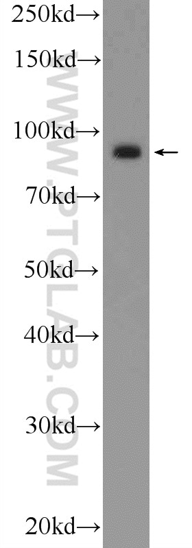 Western Blot (WB) analysis of mouse brain tissue using Importin Beta Polyclonal antibody (10077-1-AP)