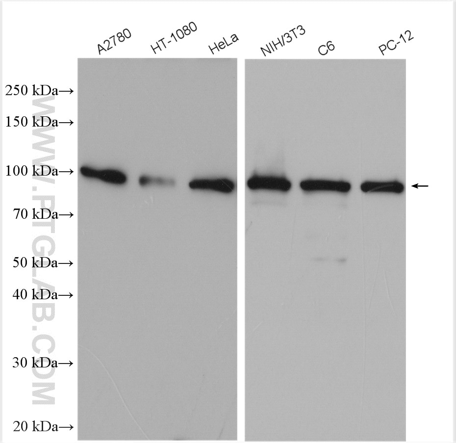 Western Blot (WB) analysis of various lysates using Importin Beta Polyclonal antibody (10077-1-AP)