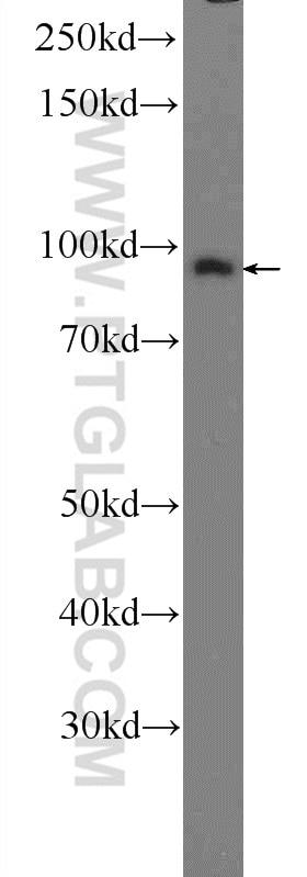 Western Blot (WB) analysis of rat brain tissue using Importin Beta Polyclonal antibody (10077-1-AP)