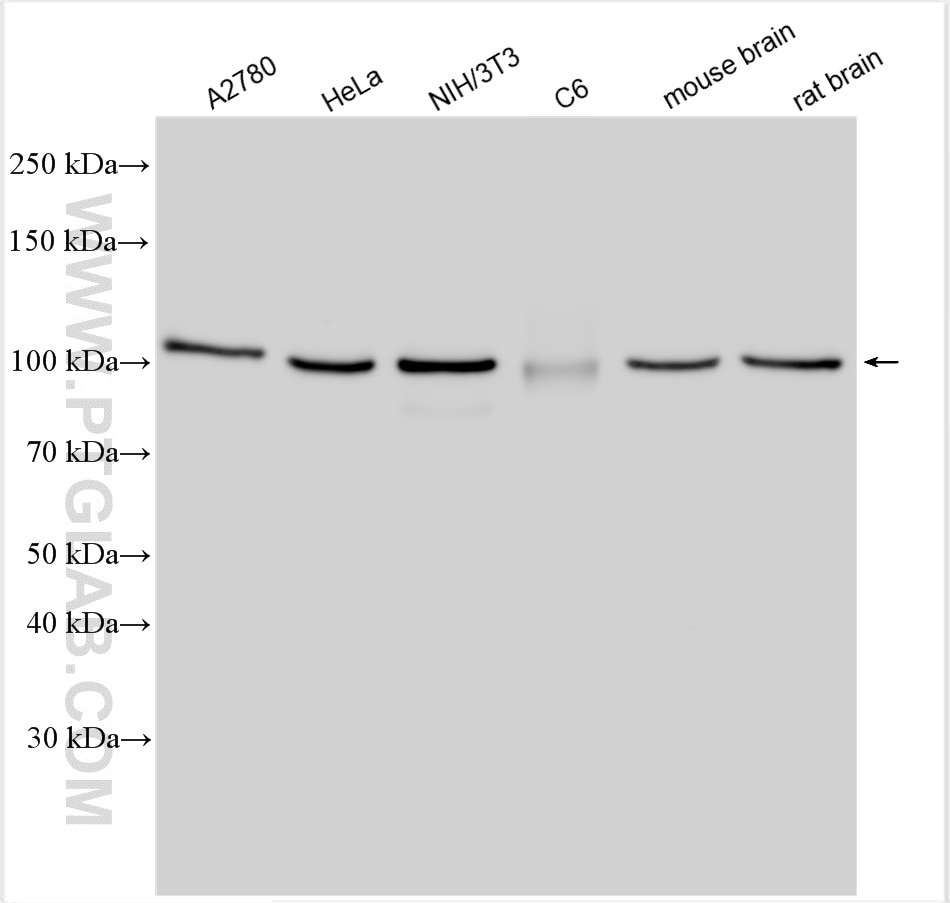 Western Blot (WB) analysis of various lysates using Importin Beta Polyclonal antibody (10077-1-AP)