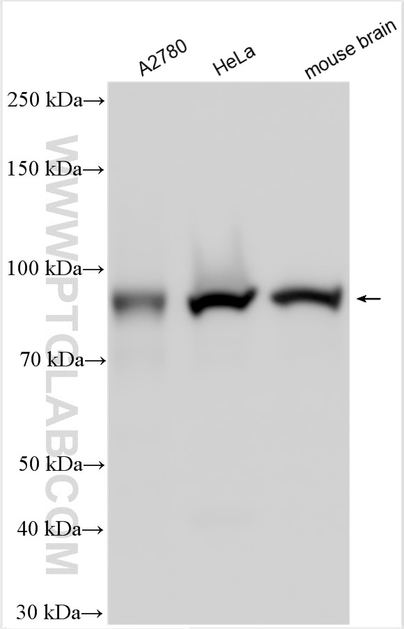 Western Blot (WB) analysis of various lysates using Importin Beta Polyclonal antibody (10077-1-AP)