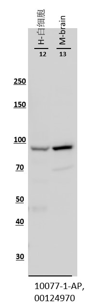 Western Blot (WB) analysis of various lysates using Importin Beta Polyclonal antibody (10077-1-AP)
