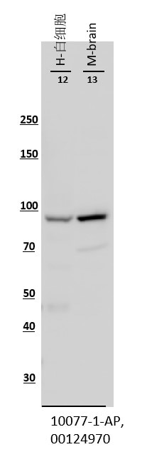 WB analysis using 10077-1-AP