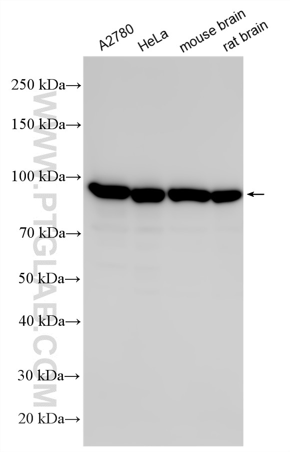 Western Blot (WB) analysis of various lysates using Importin Beta Polyclonal antibody (10077-1-AP)