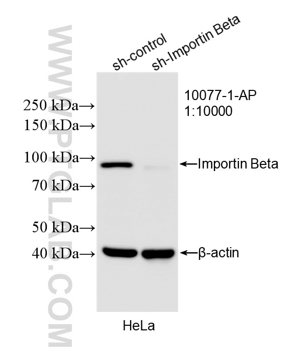 WB result of Importin Beta antibody (10077-1-AP; 1:10000; incubated at room temperature for 1.5 hours) with sh-Control and sh-Importin Beta transfected HeLa cells. Western Blot (WB) analysis of HeLa cells using Importin Beta Polyclonal antibody (10077-1-AP)