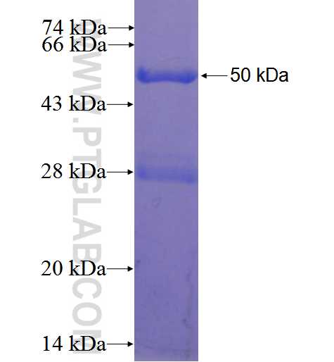 KPNB1 fusion protein Ag0122 SDS-PAGE