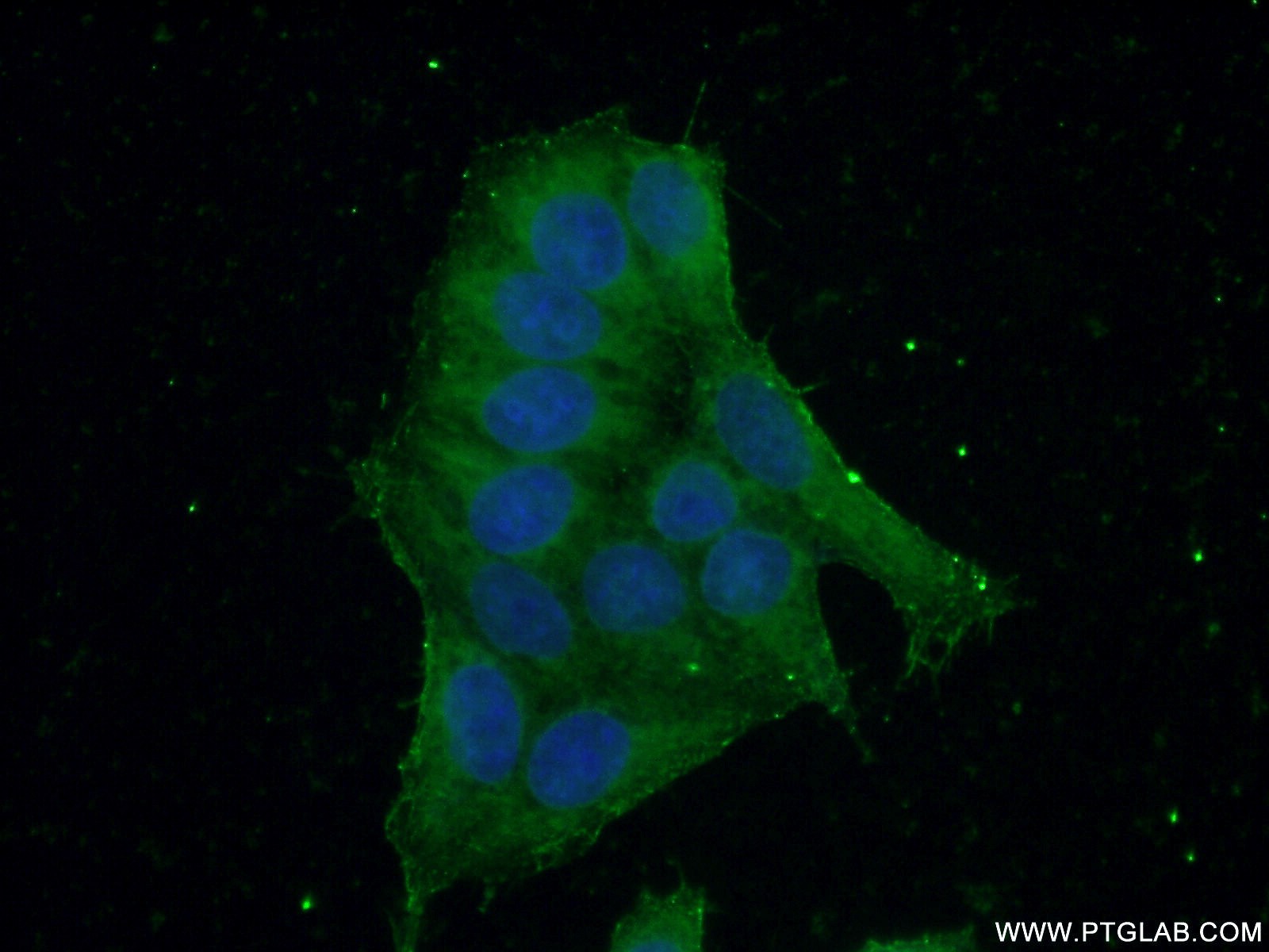 Immunofluorescence (IF) / fluorescent staining of HeLa cells using KPTN Polyclonal antibody (16094-1-AP)