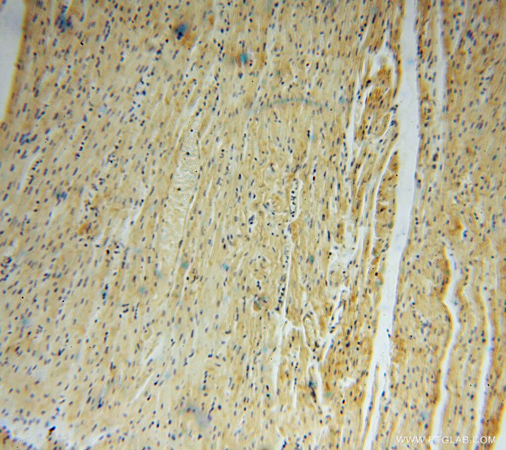 IHC staining of human heart using 16094-1-AP