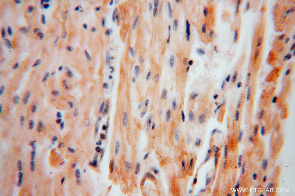 Immunohistochemistry (IHC) staining of human heart tissue using KPTN Polyclonal antibody (16094-1-AP)