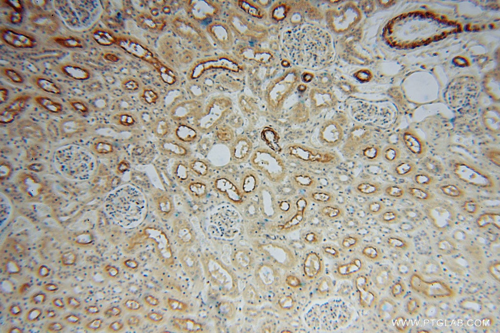 Immunohistochemistry (IHC) staining of human kidney tissue using KPTN Polyclonal antibody (16094-1-AP)