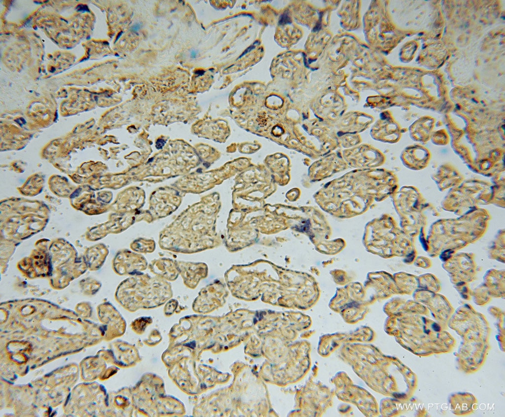 IHC staining of human placenta using 16094-1-AP