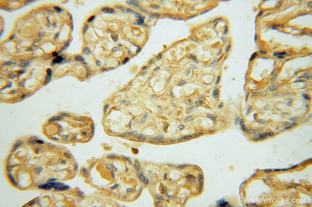 IHC staining of human placenta using 16094-1-AP