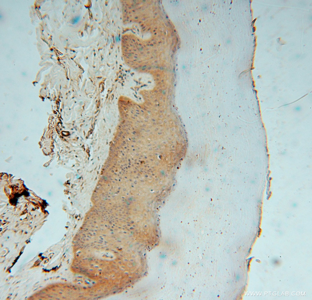 Immunohistochemistry (IHC) staining of human skin tissue using KPTN Polyclonal antibody (16094-1-AP)