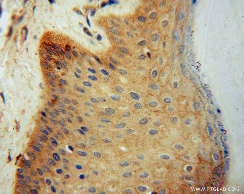 IHC staining of human skin using 16094-1-AP