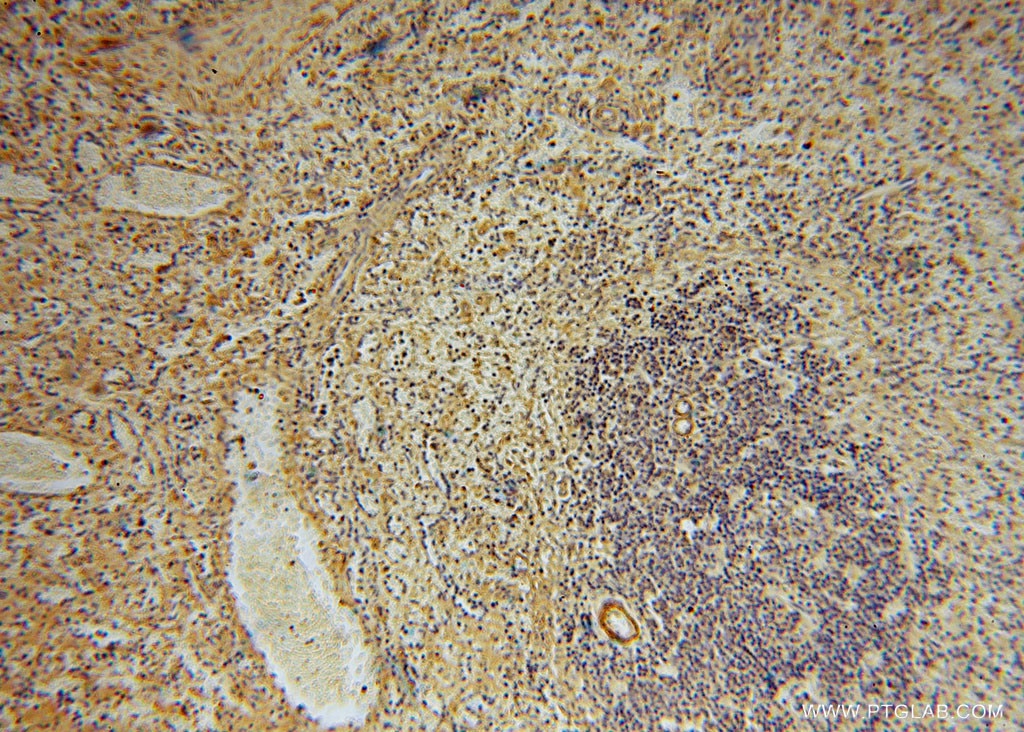 Immunohistochemistry (IHC) staining of human spleen tissue using KPTN Polyclonal antibody (16094-1-AP)