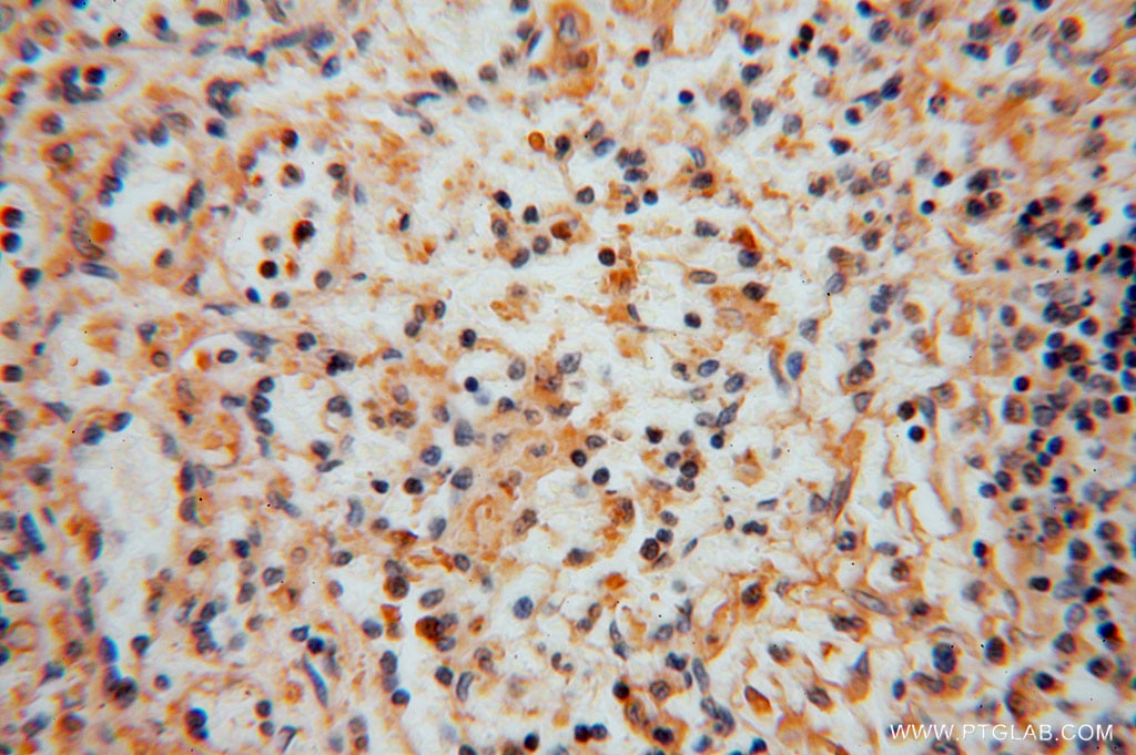 Immunohistochemistry (IHC) staining of human spleen tissue using KPTN Polyclonal antibody (16094-1-AP)