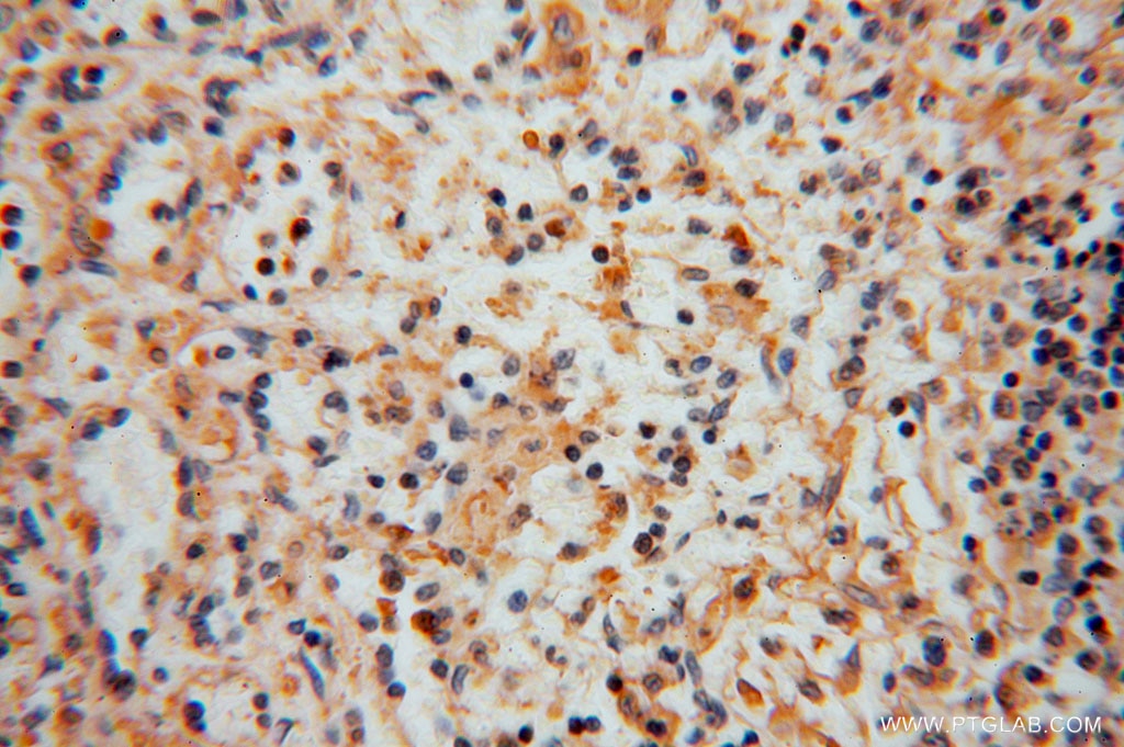 IHC staining of human spleen using 16094-1-AP