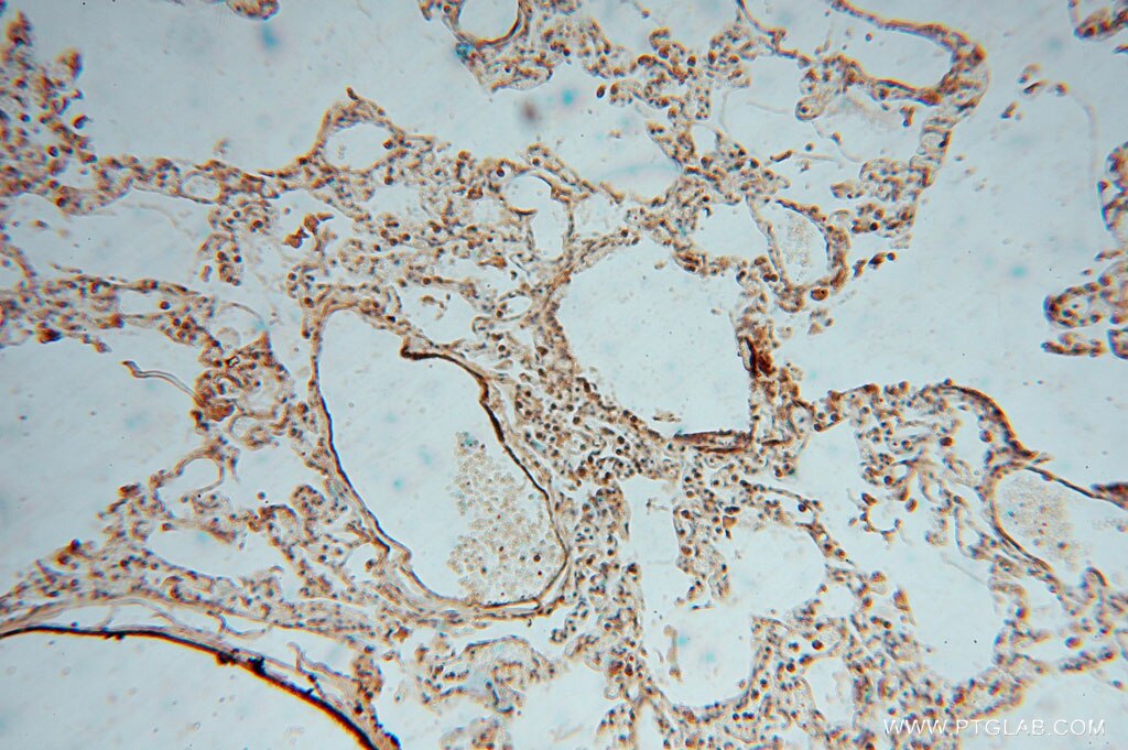 IHC staining of human lung using 16094-1-AP