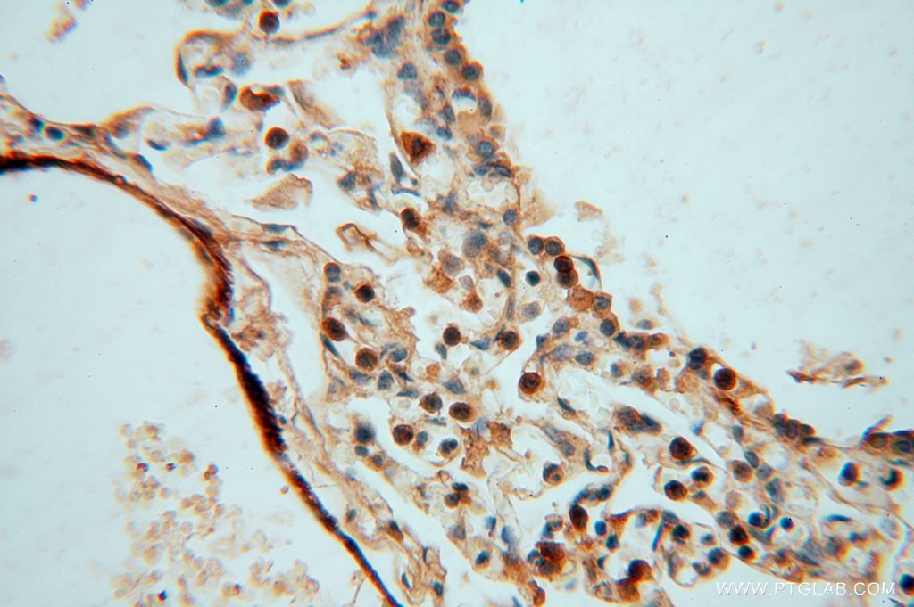 Immunohistochemistry (IHC) staining of human lung tissue using KPTN Polyclonal antibody (16094-1-AP)