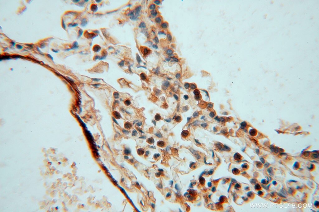 IHC staining of human lung using 16094-1-AP