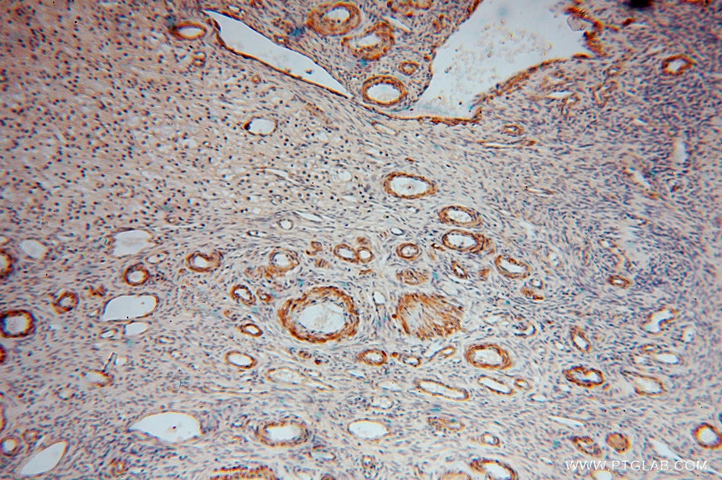 Immunohistochemistry (IHC) staining of human ovary tissue using KPTN Polyclonal antibody (16094-1-AP)