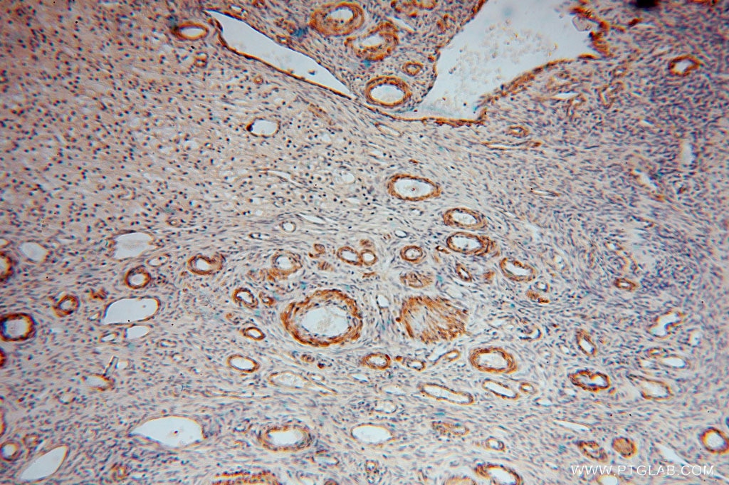 IHC staining of human ovary using 16094-1-AP