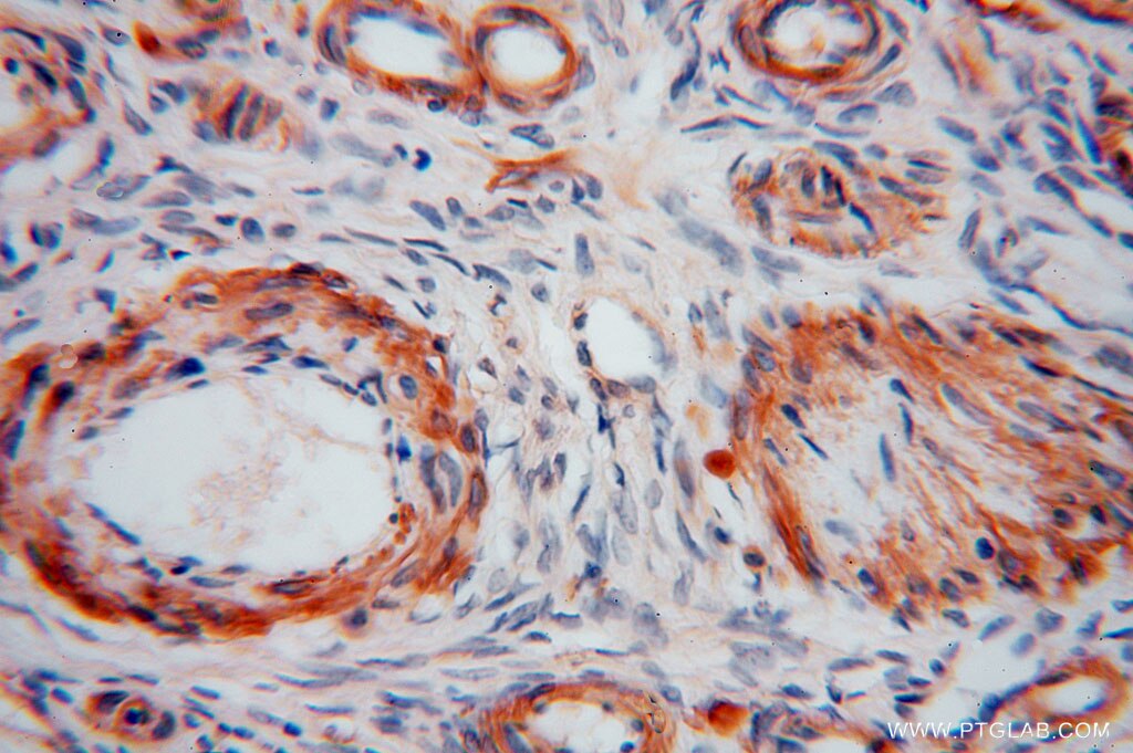 Immunohistochemistry (IHC) staining of human ovary tissue using KPTN Polyclonal antibody (16094-1-AP)