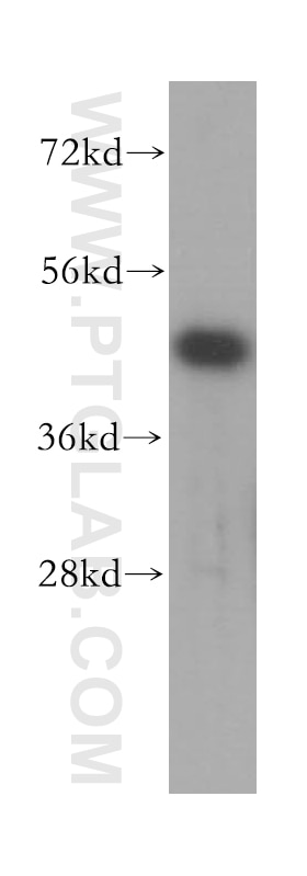 Western Blot (WB) analysis of HeLa cells using KPTN Polyclonal antibody (16094-1-AP)