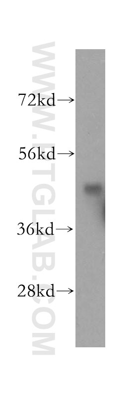 Western Blot (WB) analysis of human cerebellum tissue using KPTN Polyclonal antibody (16094-1-AP)