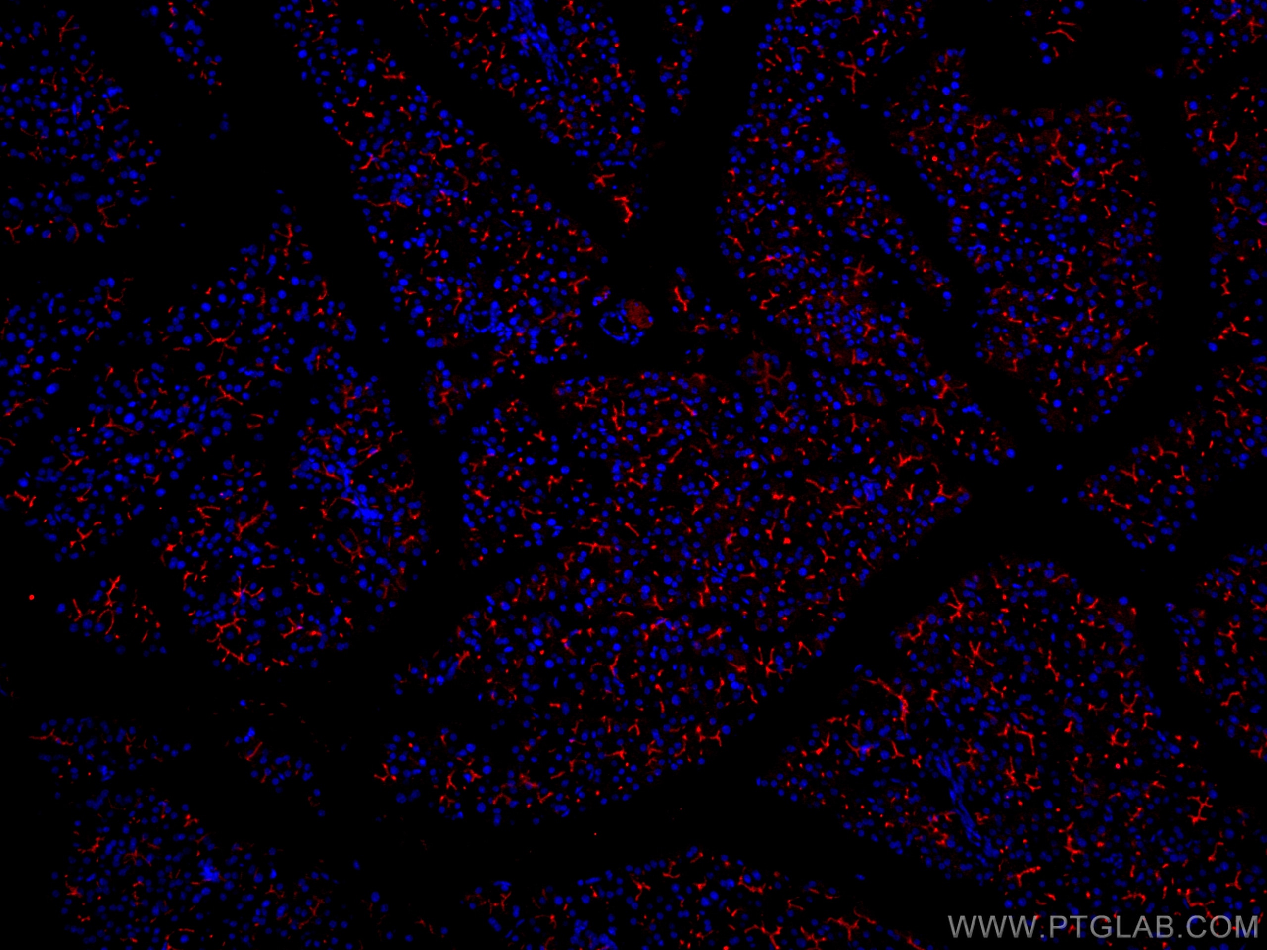 Immunofluorescence (IF) / fluorescent staining of mouse pancreas tissue using CoraLite®594-conjugated KRAP/SSFA2 Polyclonal anti (CL594-14157)