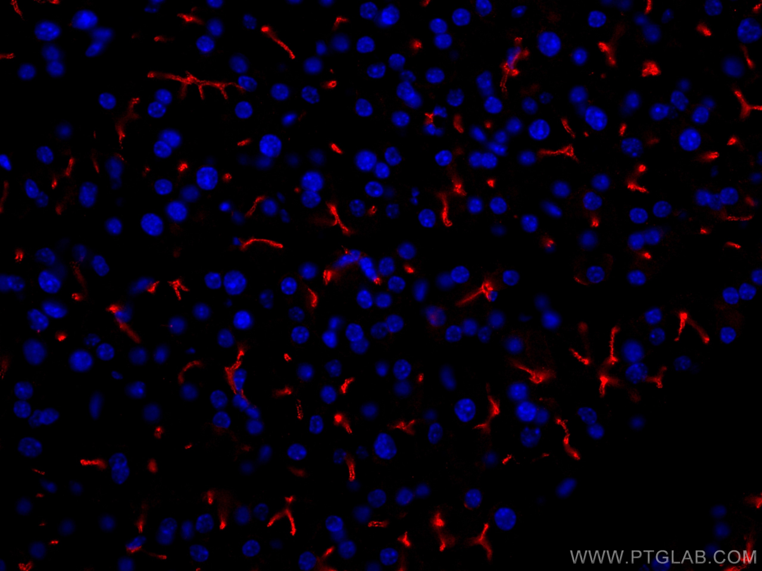 IF Staining of mouse pancreas using CL594-14157