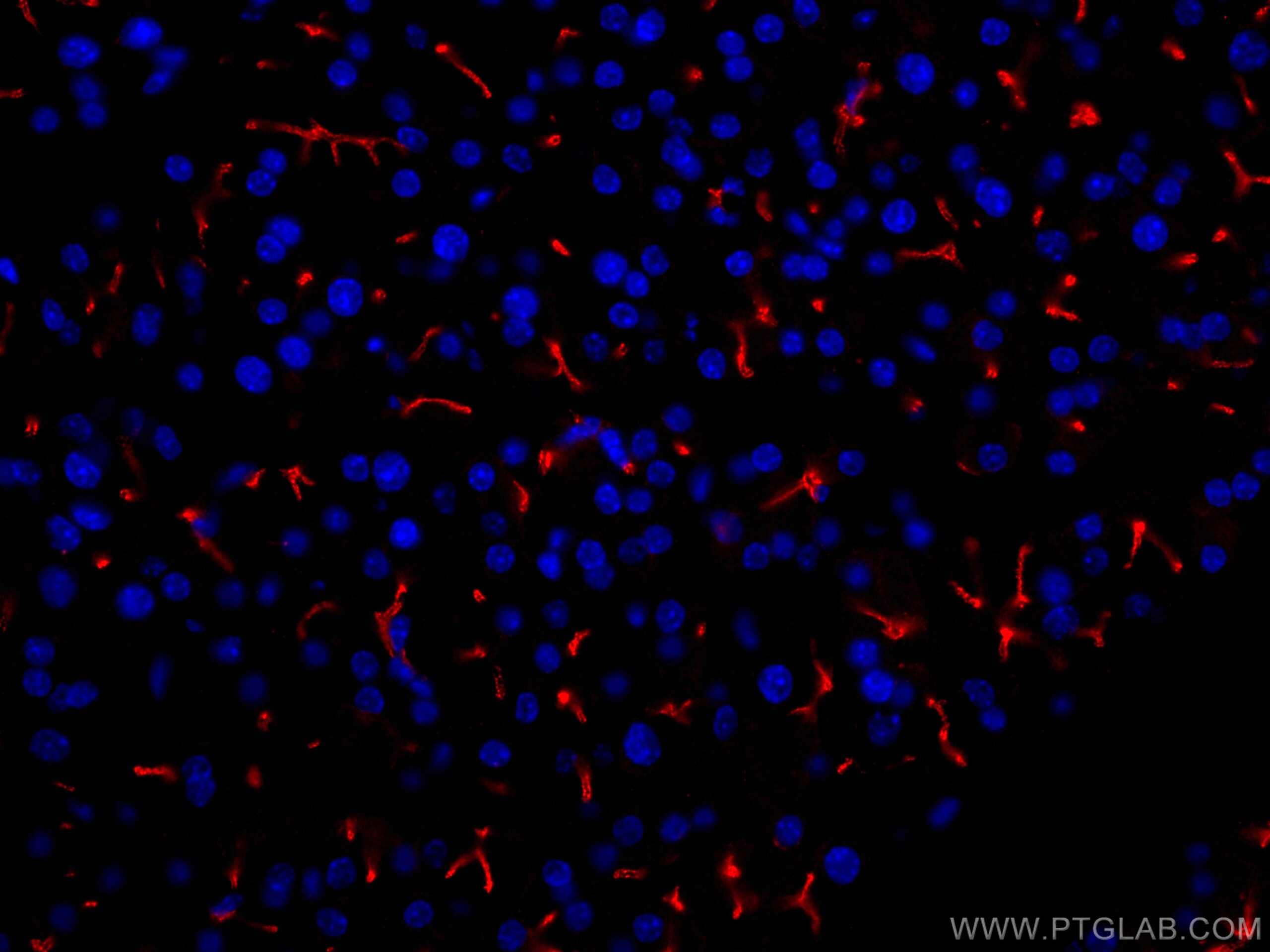 Immunofluorescence (IF) / fluorescent staining of mouse pancreas tissue using CoraLite®594-conjugated KRAP/SSFA2 Polyclonal anti (CL594-14157)