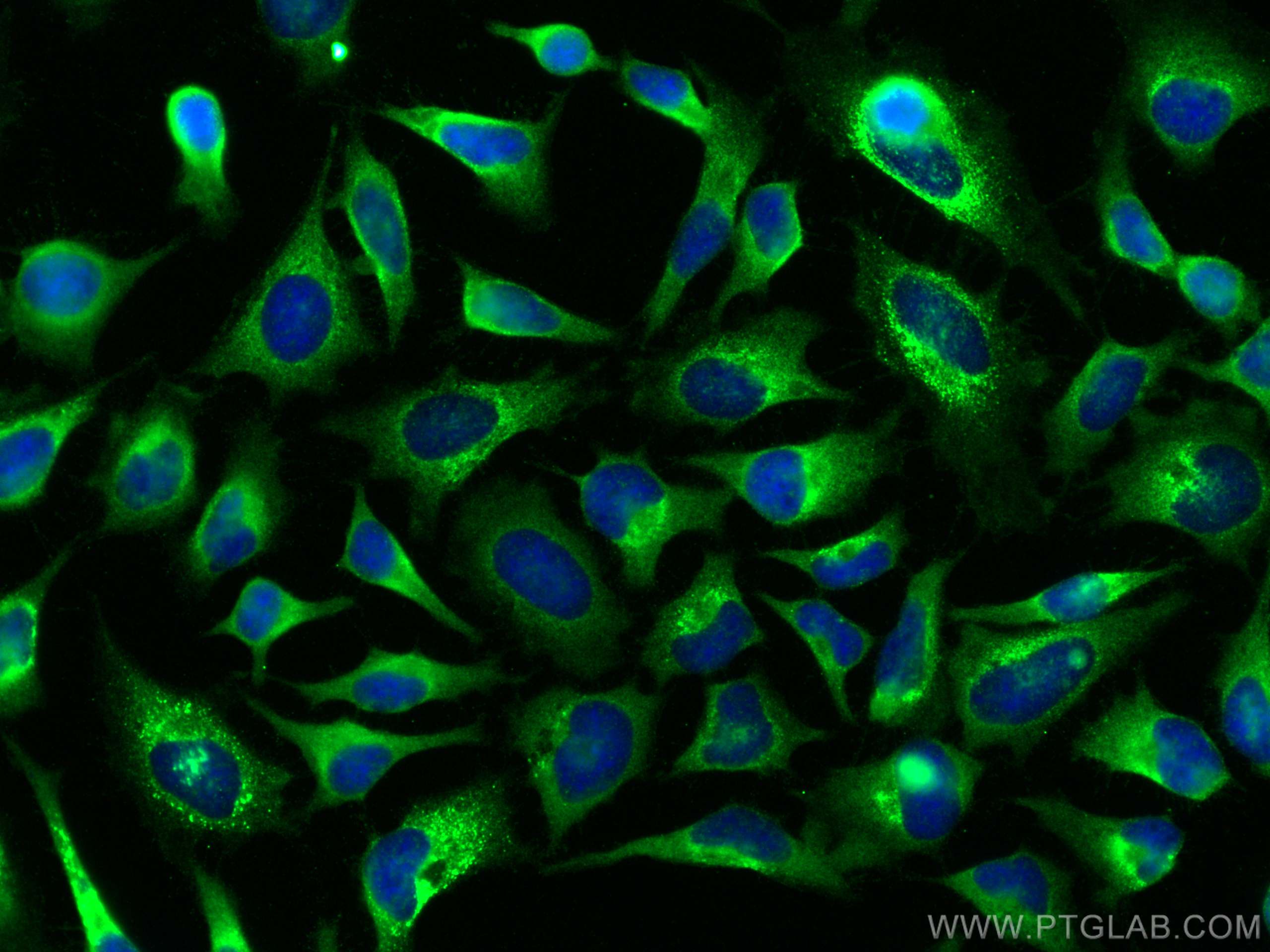 Immunofluorescence (IF) / fluorescent staining of HeLa cells using KRAS Polyclonal antibody (12063-1-AP)