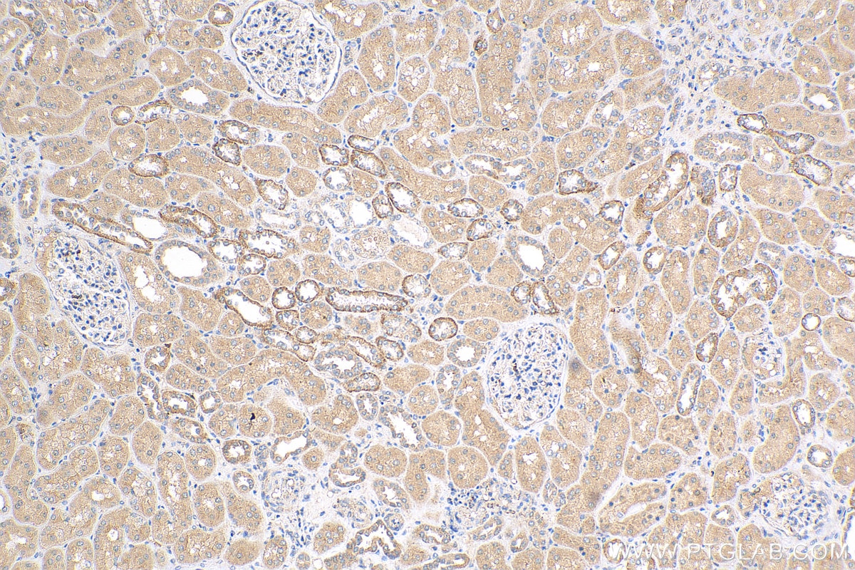 Immunohistochemistry (IHC) staining of human kidney tissue using KRAS Polyclonal antibody (12063-1-AP)