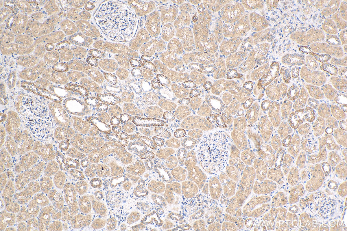 IHC staining of human kidney using 12063-1-AP