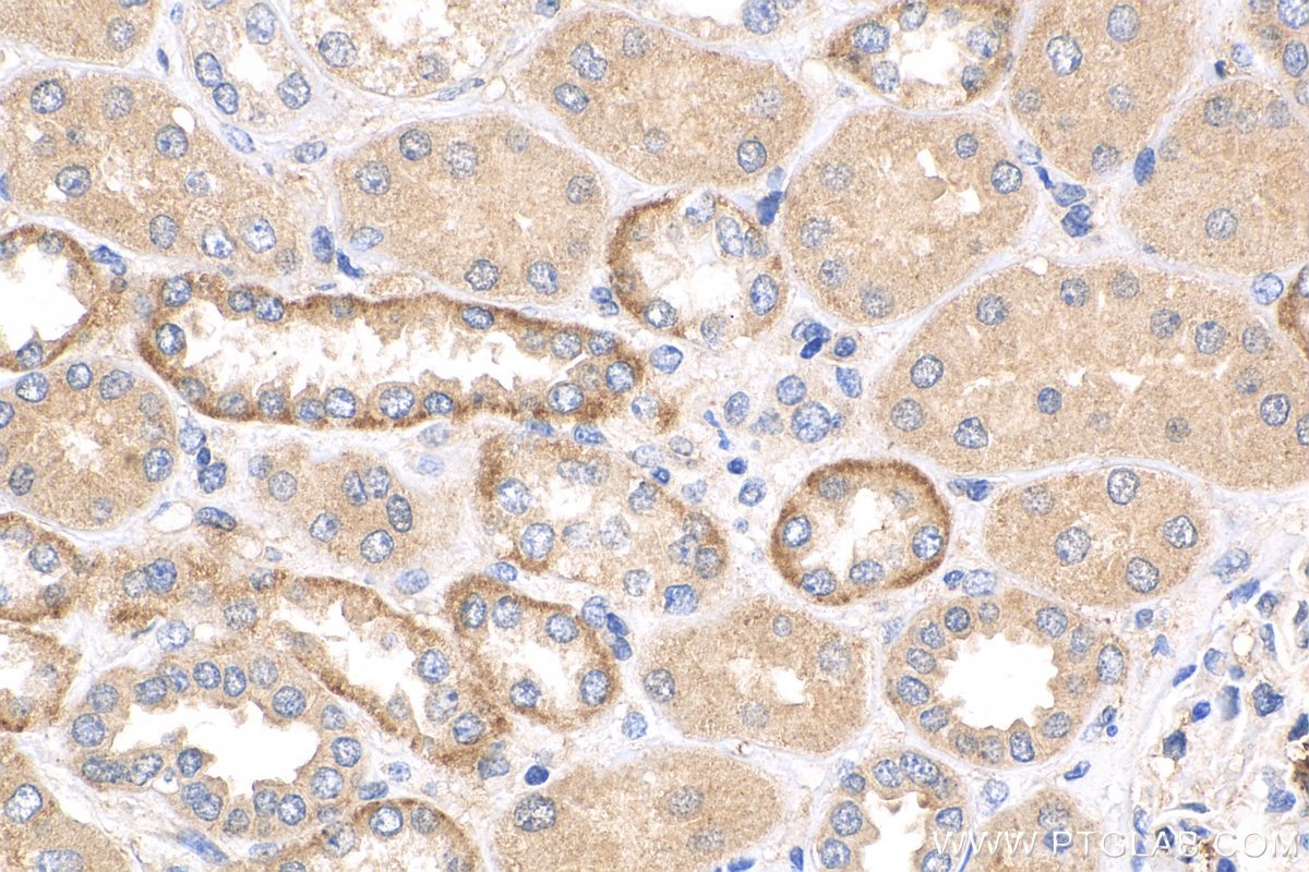 IHC staining of human kidney using 12063-1-AP