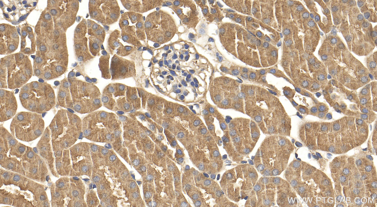 Immunohistochemistry (IHC) staining of mouse kidney tissue using KRAS Polyclonal antibody (12063-1-AP)