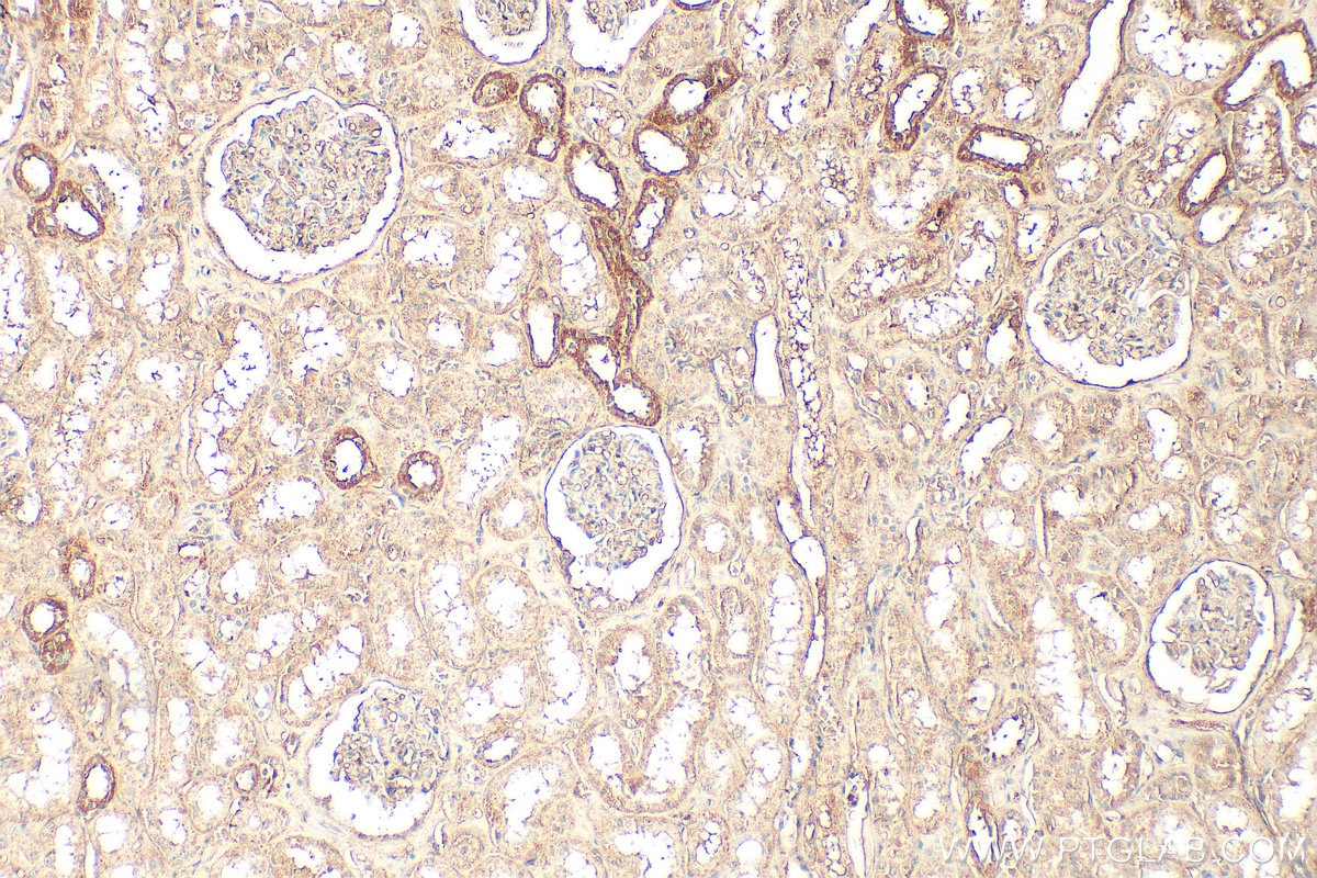 Immunohistochemistry (IHC) staining of human kidney tissue using KRAS Polyclonal antibody (12063-1-AP)
