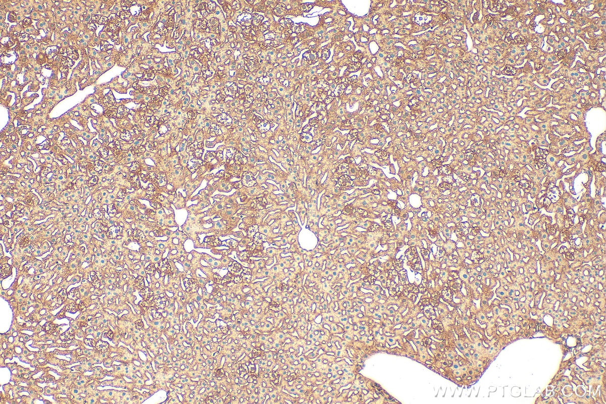 Immunohistochemistry (IHC) staining of mouse liver tissue using KRAS Polyclonal antibody (12063-1-AP)